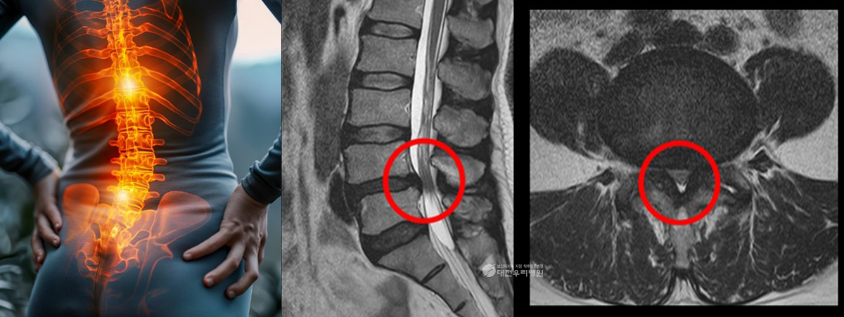 ô�� ���� �� ��Ȱġ��