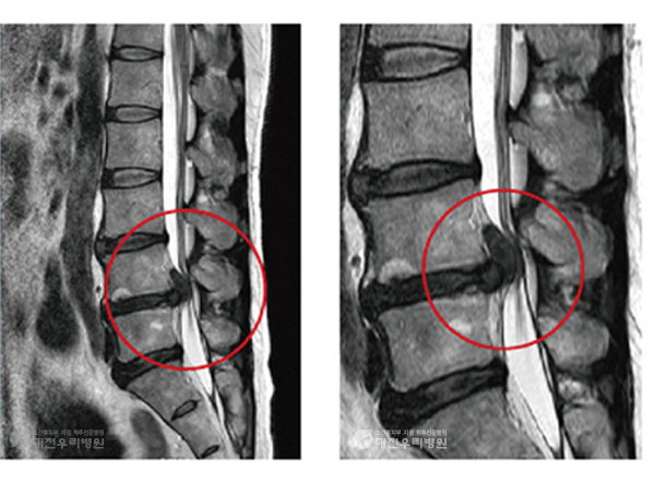 ô�� ���� �� ��Ȱġ��