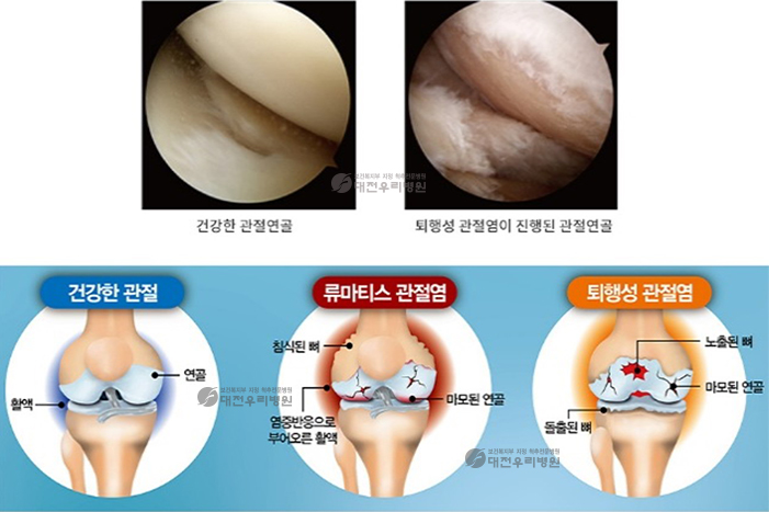 ô�� ���� �� ��Ȱġ��