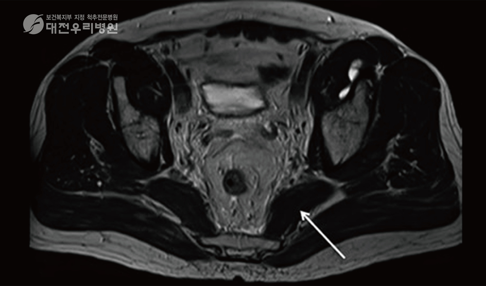 ���ĵ� �̻�� MRI ����