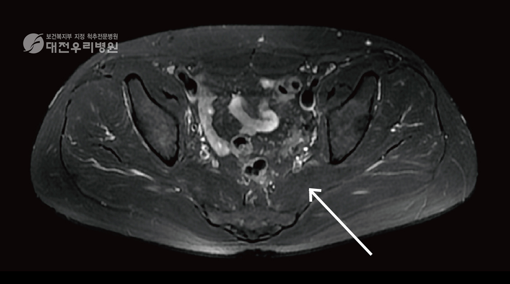 ���� �̻�� MRI ����
